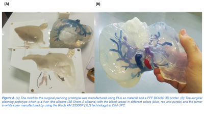 Nou article publicat: "3D Printing in Medicine for Preoperative Surgical Planning: A Review"